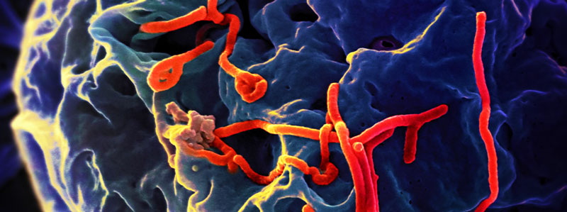 Microscopic view of Ebola virus budding from the surface of a Vero cell