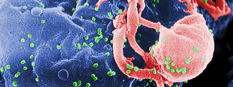 Microscopic view of HIV attacking human cells